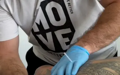 Dry Needling: How This Powerful Therapy Relieves Pain and Restores Movement